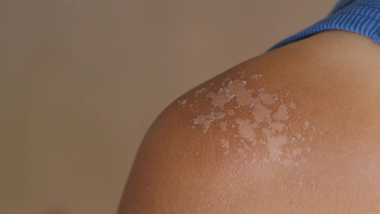 Дальнейший уход и восстановление