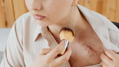 Народні засоби від шрамів і рубців