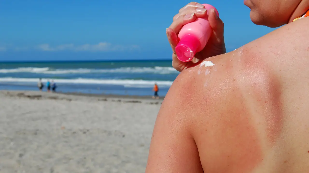 Профилактика будущих ожогов